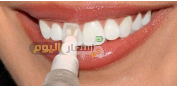 Photo of سعر طربوش الأسنان محدث 2022