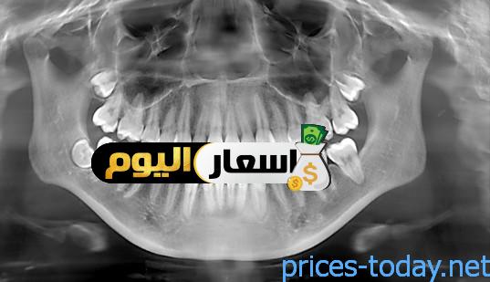 Photo of سعر أشعة الأسنان في مصر 2023