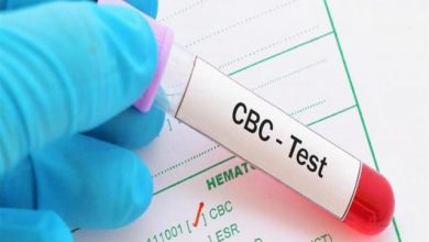 Photo of سعر تحليل cbc فى المعامل المختلفة 2025