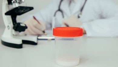 Photo of سعر تحليل السائل المنوي 2025