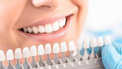 Photo of اسعار تلبيس الأسنان 2025