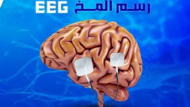 Photo of اسعار رسم المخ فى مصر 2025