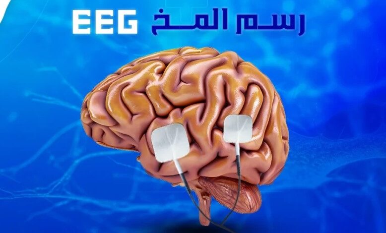 اسعار رسم المخ فى مصر